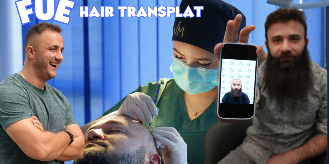 Follicular Unit Extraction (FUE) Hair Transplantation: A Comprehensive Overview